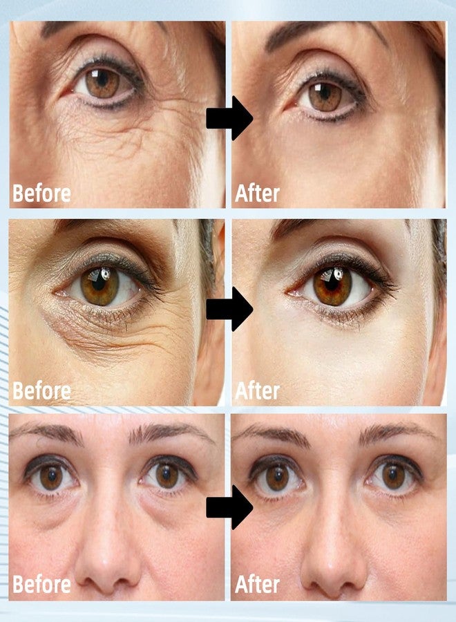 GROEI 60Pcs Eye Patches for Puffy Eyes – Retinol Collagen Hydrogel Under Eye Patches - Dark Circles, Fine Lines – Hydrating, Firming, Brightening Skincare for All Skin Types - Image 2